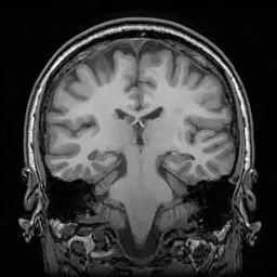 Hippocampus Segmentation Model