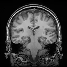 Hippocampus Segmentation Model