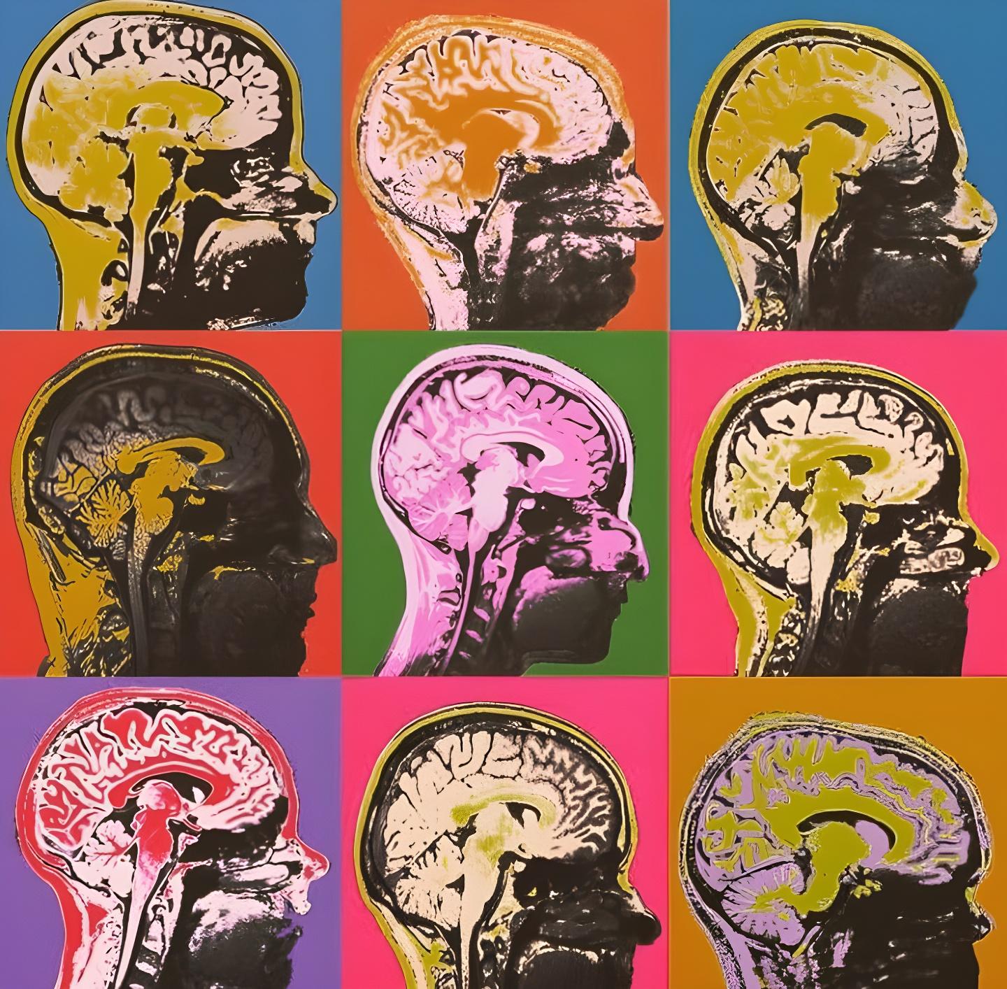 Hippocampus Brain Structure