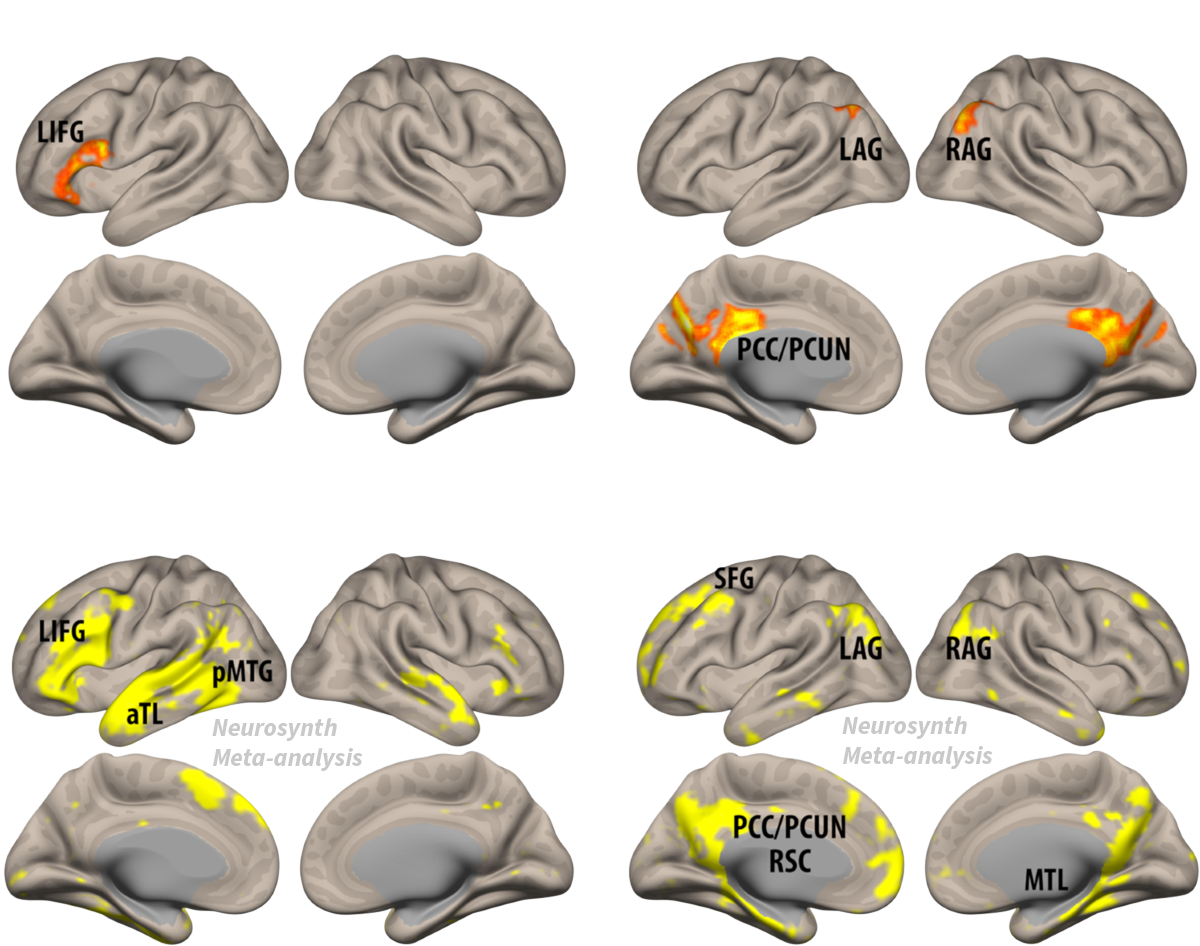 Brain activation maps comparing episodic and semantic memory networks.